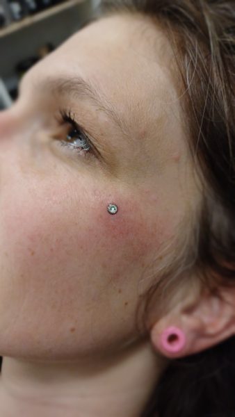 microdermal