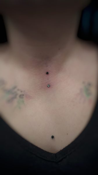 microdermal